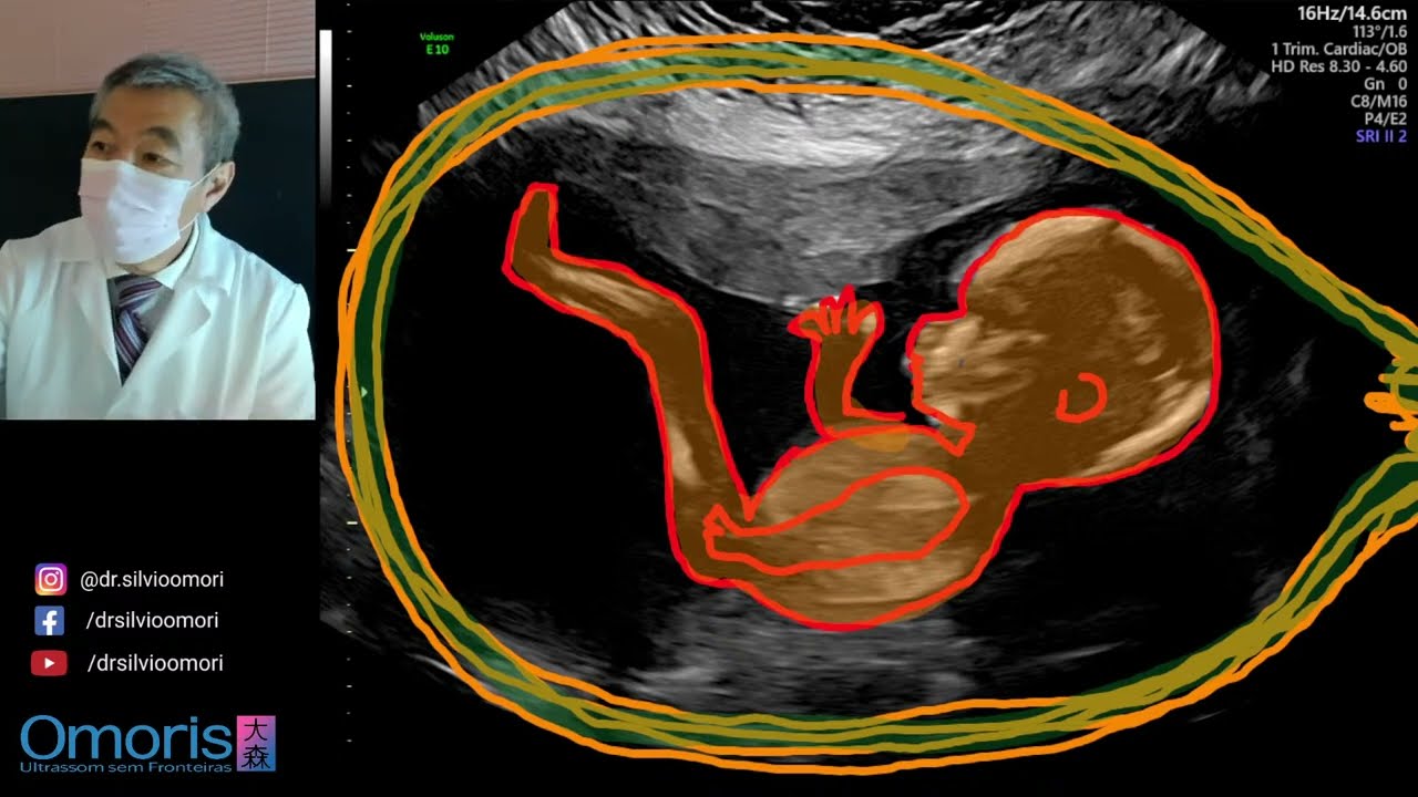 é normal fazer ecografia com 3 meses e nao ver nada｜TikTok Search