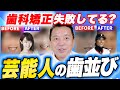 【忖度なし】芸能人の歯並びを歯医者が徹底解説【セラミック矯正/新庄さん】
