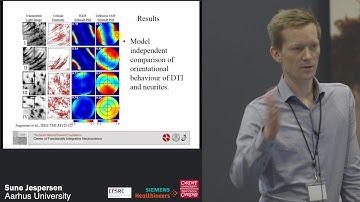 The Neurite model of Diffusion in Brain Tissue - Sune Jespersen