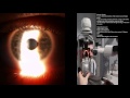 Slit Lamp: Sclerotic scatter Mp3 Song