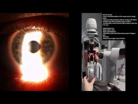 Slit Lamp: Sclerotic scatter