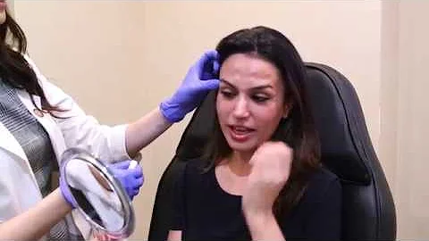 Neurotoxin: Botox, Dysport ,Xeomin, and Jeuveau  - Glow Aesthetic Center