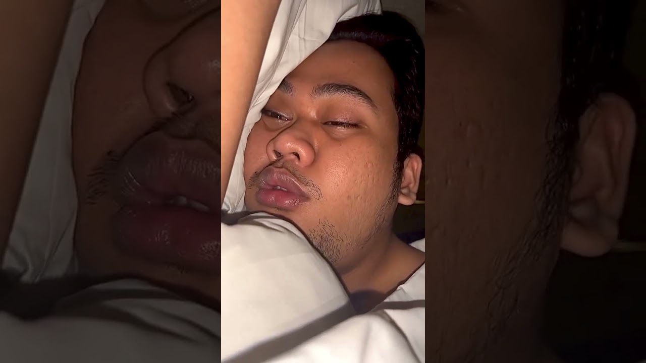 Sleep with open eyes, snoring, big nose, open mouth 