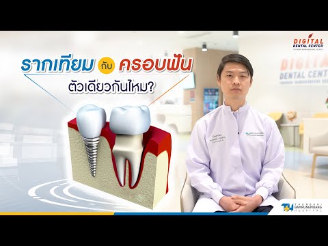 รากเทียม กับ ครอบฟัน ใช่ตัวเดียวกันไหม |   