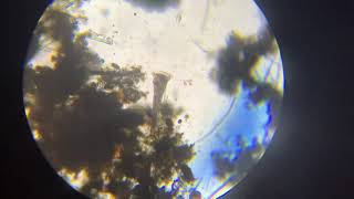 Stentor coeruleus under microscope