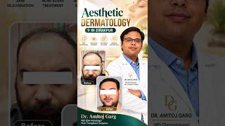 Best Dermatologist in Zirakpur | Aesthetic Skin & Hair Treatments | Dr. Amitoj Garg