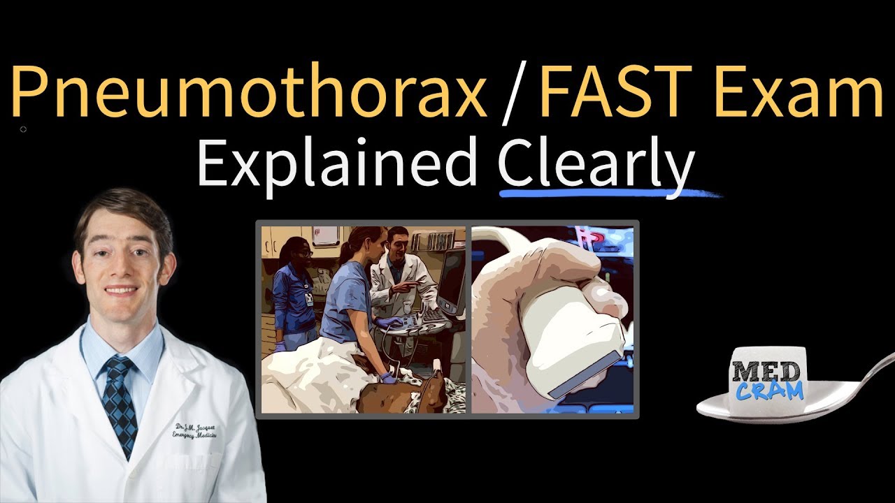 Pneumothorax On Ultrasound FAST Exam Explained Clearly YouTube Pneumothorax On Ultrasound FAST Exam Explained Clearly YouTube