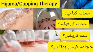 Hijama | Cupping therapy | Hijama center in Karachi | Al-Huda Hijama Center