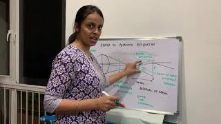 Errors of Refraction Part-3 : Astigmatism