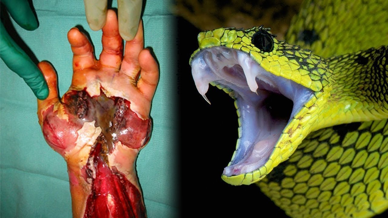 Cual es la serpiente más venenosa del mundo