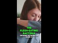 Flesh-Eating Bacteria Treatment Beverly Hills