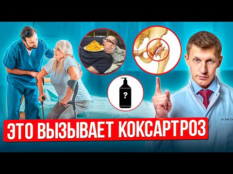 Коксартроз: топ 5 причин заболевания. Как уберечь себя от артроза тазобедренного сустава.