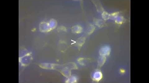 Collecting individual SH-SY5Y using KuiqpicK