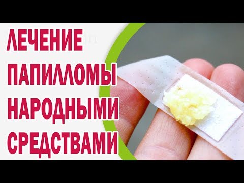 Плоские папилломы на лице лечение