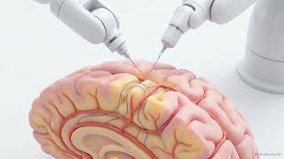 Brain Computer Interfaces — How Neuralink Works