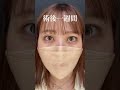 【大人気YouTuberふくれな】二重整形+目頭切開　#shorts