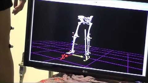 Gait Training with Bertec, Vicon, and The MotionMonitor®