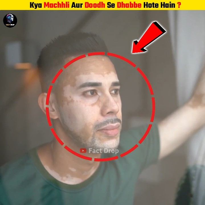 Kya Machhli Aur Doodh Se Dhabbe Hote Hain ? Fact Drop - YouTube