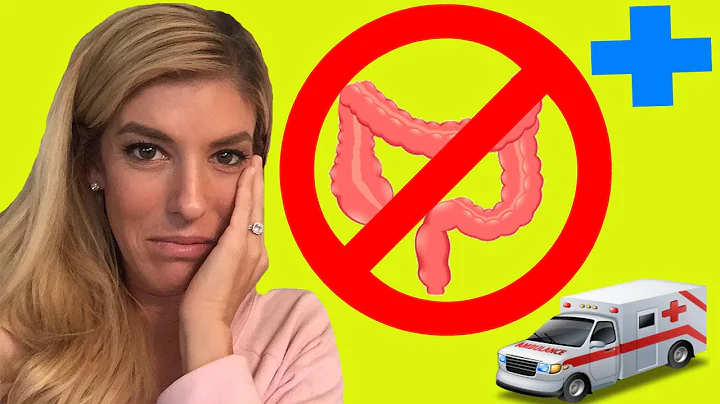 I DON'T HAVE A COLON