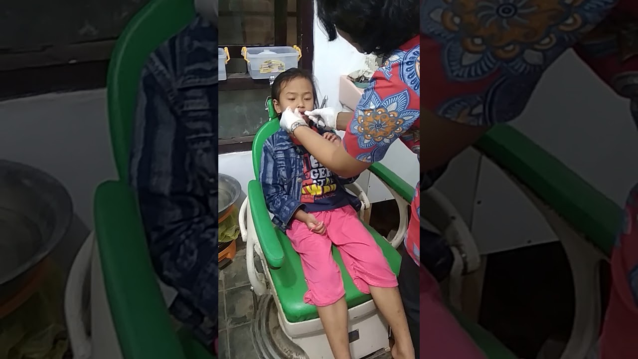 Cabut gigi anak,gak usah takut ya 😀 - YouTube