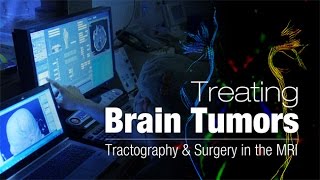 Brain Tumors Tractography and Surgery in the MRI  Health Matters