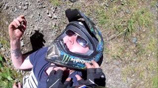 Crazy Dirt Bike Crash + Broken Bones