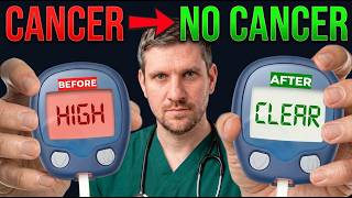 CANCER → NO CANCER: The 3-Day Cell Reset Most Seniors Never Try
