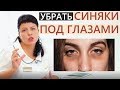 👍Как убрать синяки под глазами 😱👍 Патчи и процедуры от синяков под глазами👍