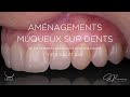 Ifcia hadi antoun  dr sylvie pereira prsente sa session  amnagements muqueux sur dents