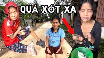 Làng Cùi Gia Lai, Quá Xót Xa Cho Những Bệnh Nhân Phong Cùi, Cụt Tây Chân Sống Rất Khổ Sở