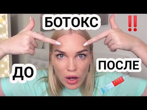 Видео: Может ли ботокс вызвать слезотечение?