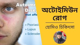 অটোইমিউন রোগের চিকিৎসা। ডাঃ মাসুদ হোসেন। screenshot 5