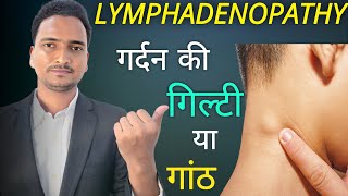 गिल्टी और गांठ की दवा | Lymph nodes enlargement medicine homeopathy | Lymphadenopathy treatment screenshot 1