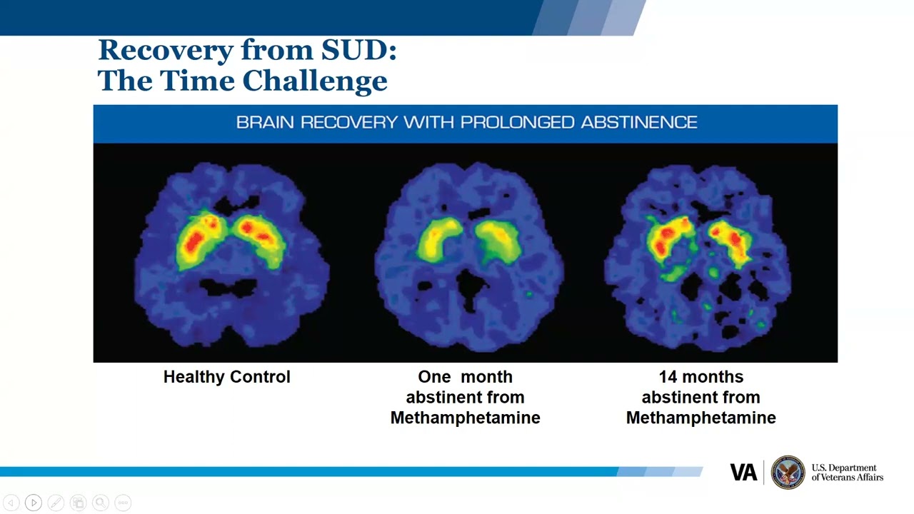 Reinforcing Recovery with Contingency Management for Pregnant and Parenting People