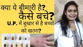 Scrub Typhus / क्या यूपी में फैल रही स्क्रब टाइफस बीमारी? Viral fever in U.P? बच्चों को खतरा?