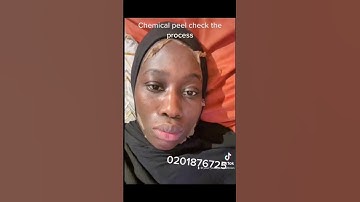 Thumbnail of Chemical peel on face #reels #trending #viral #foryou
