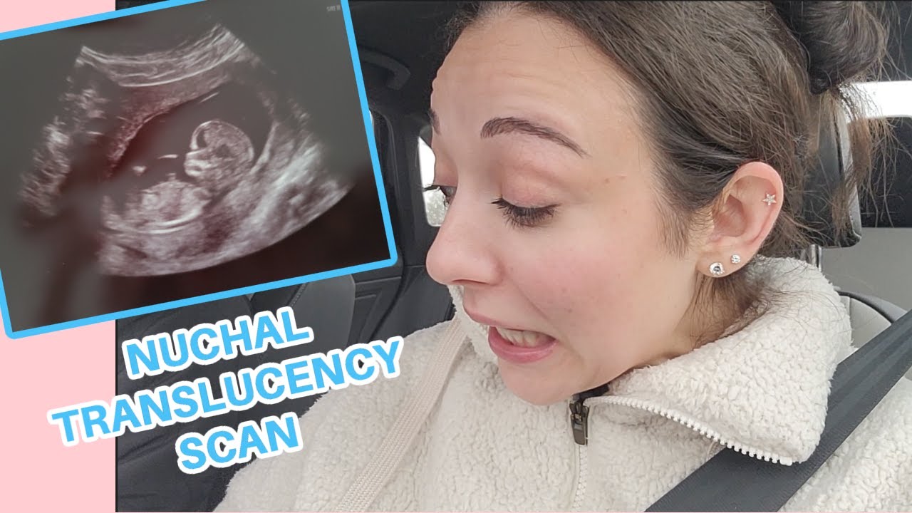 The Worst Pain Ever First Ultrasound At Nearly 12 Weeks YouTube the-worst-pain-ever-first-ultrasound-at-nearly-12-weeks-youtube