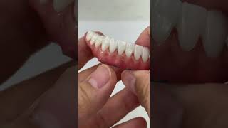 Super thin full mouth implants!