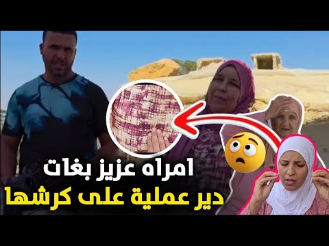 جانا خبر من عين سيخ امراه عزيز بغات دير عمليه على الكرش ديالها تفاصيل في الفيديو