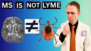 Multiple Sclerosis is not Lyme Disease