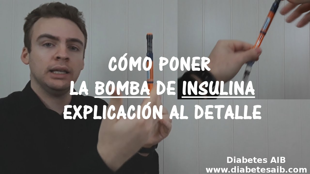 Tutorial cómo poner bomba de insulina | Diabetes AIB #diabetes #diabetestipo1 #bombainsulina