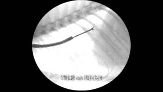 Veterinary Bronchoscopy Pulmonary Carcinoma In A Cat, Bronchioloalveolar Carcinoma Type