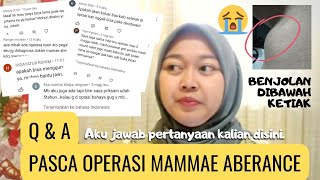 Is Mammae Aberration Dangerous or Not