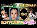 加工せずに自撮りできる憧れの顔に！形成外科、美容外科医歴30年以上のベテランドクターの神業 #リッツ美容外科 #SBCグループ