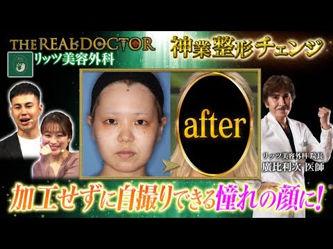 加工せずに自撮りできる憧れの顔に！形成外科、美容外科医歴30年以上のベテランドクターの神業 #リッツ美容外科 #SBCグループ