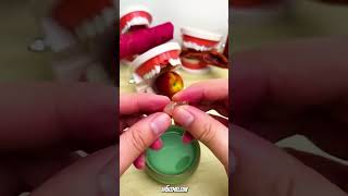 Tooth Repair Kit