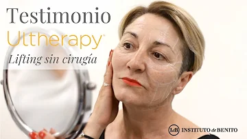 ¿Es Ultherapy seguro para la cara?