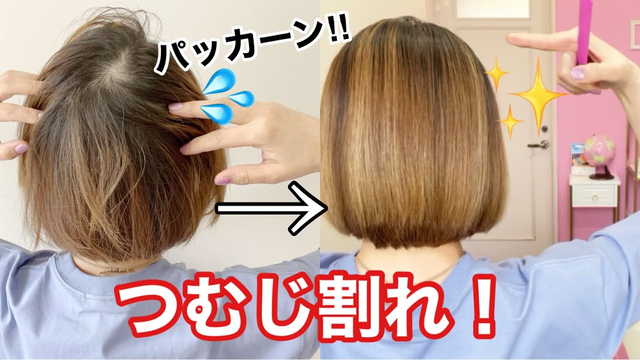 後頭部 つむじ 割れ 女