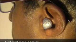 Ear Plug Removal Guide