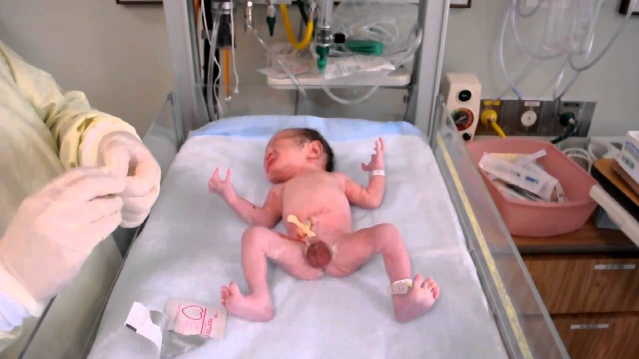 CJT 01-22-2011 Mins after born video